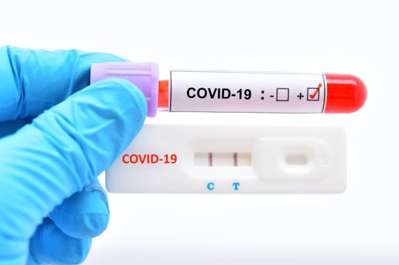 Tips for Canadians Who Have a Positive Pre- Arrival COVID-19 Test Before Travelling